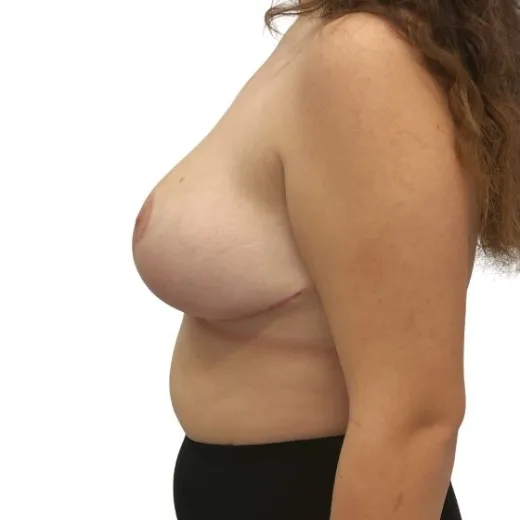 Image after