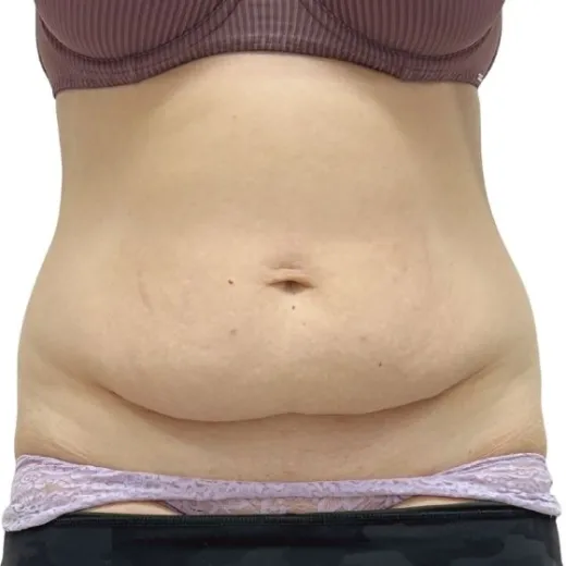 Image before