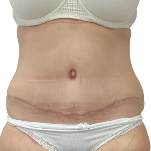Image after