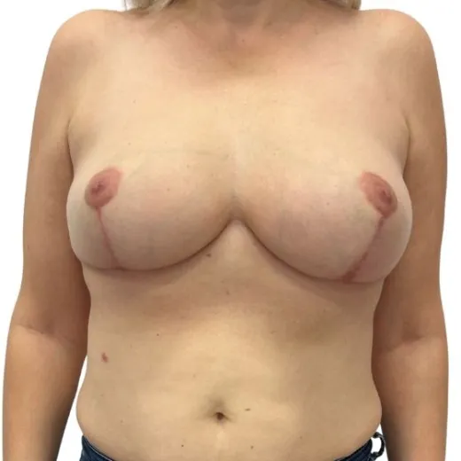 Image after