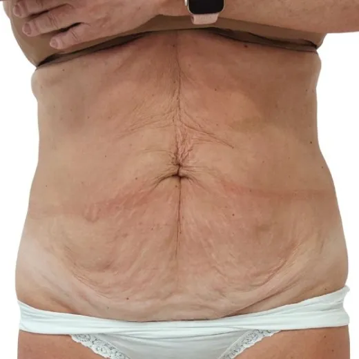 Image before