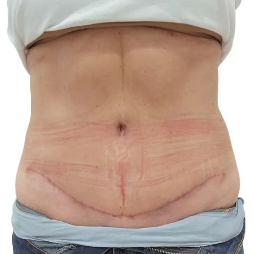 Image after