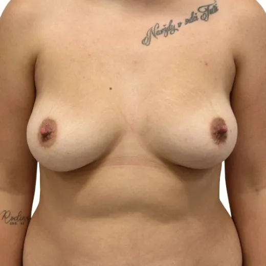 Image before
