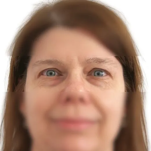 Image before