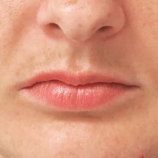 Image before