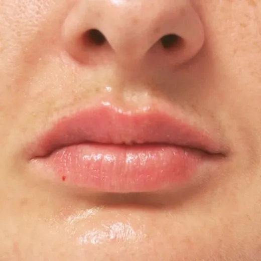 Image after