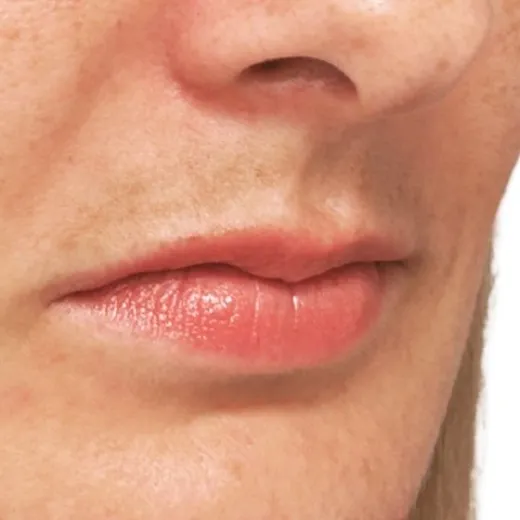 Image before