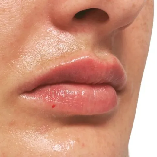 Image after