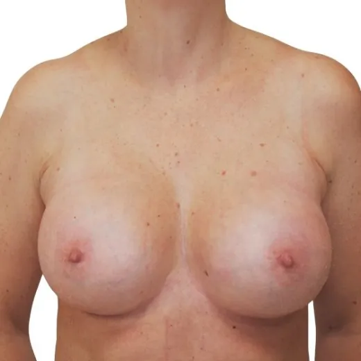 Image after