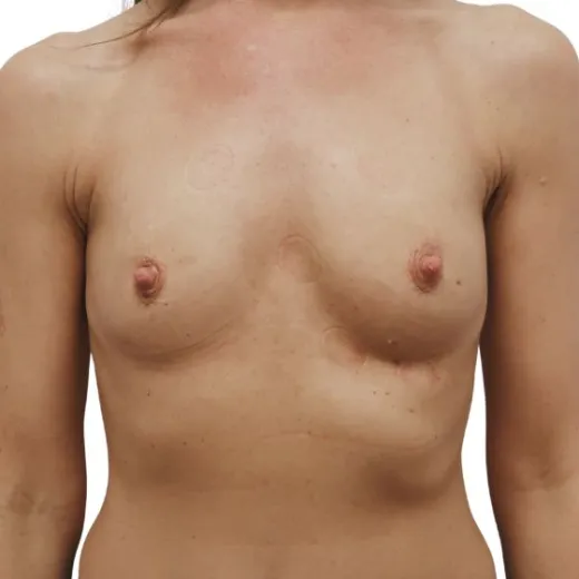 Image before