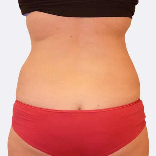 Image after