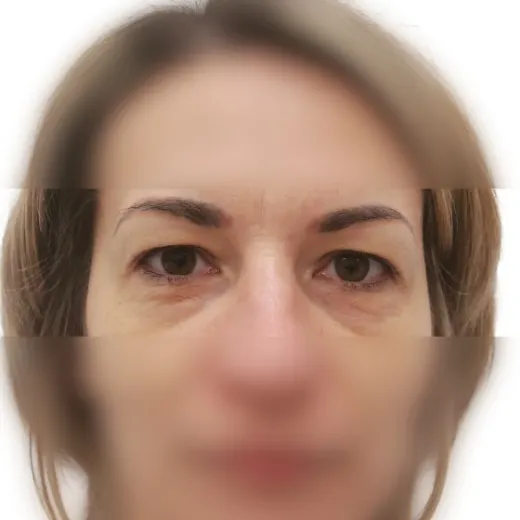 Image before