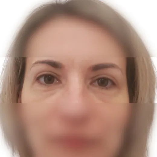 Image after