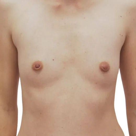 Image before