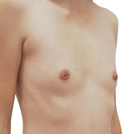 Image before