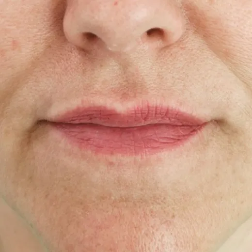 Image before
