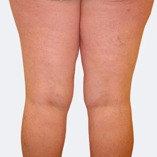 Image after