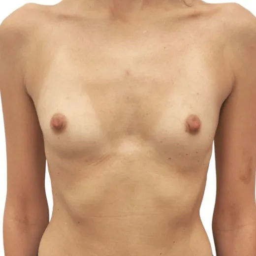 Image before