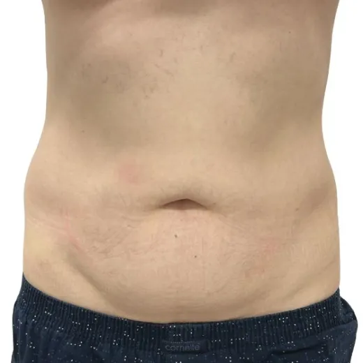 Image before