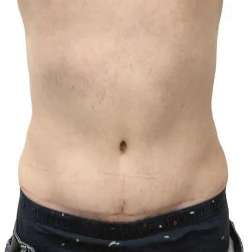 Image after