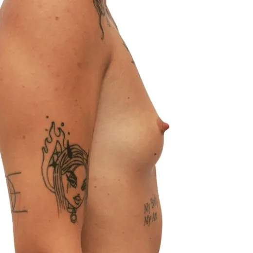 Image before