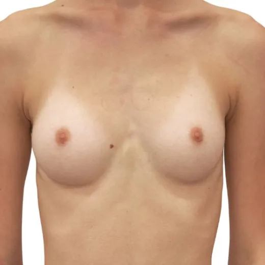 Image before