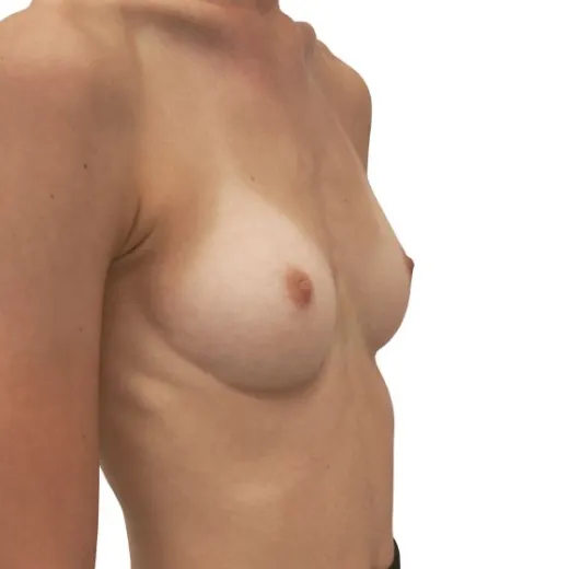 Image before