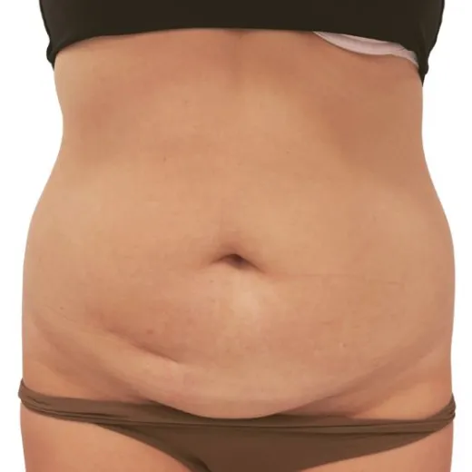 Image before