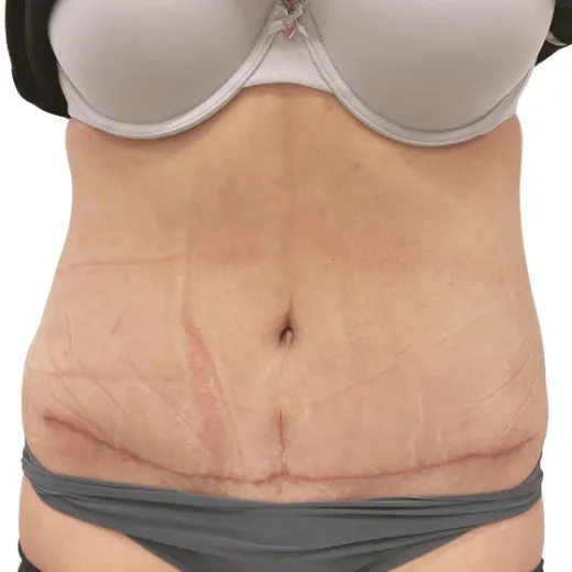 Image after