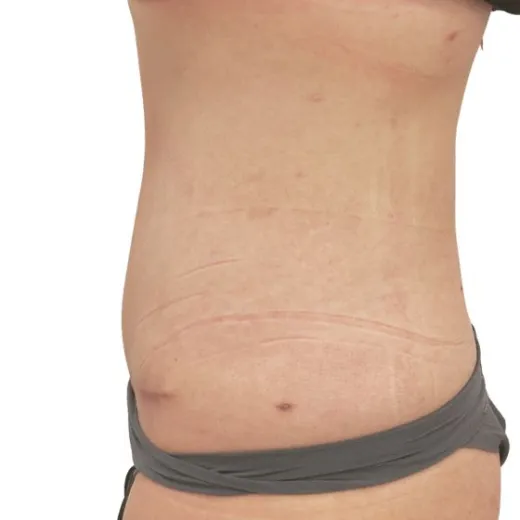 Image after