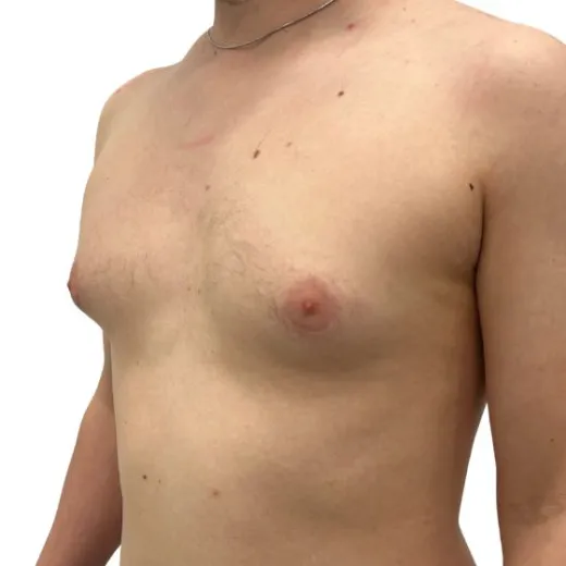 Image before