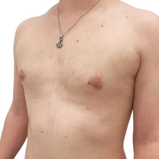 Image after
