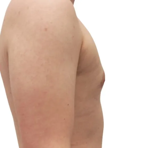 Image after