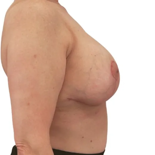 Image after