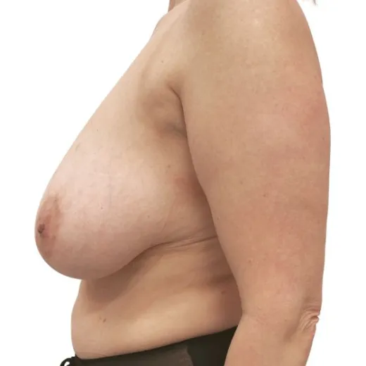 Image before