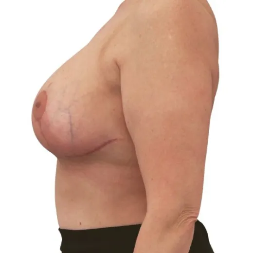 Image after