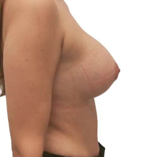 Image after