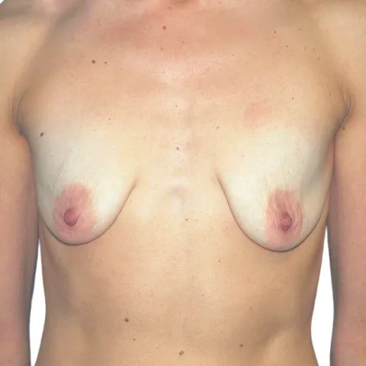 Image before