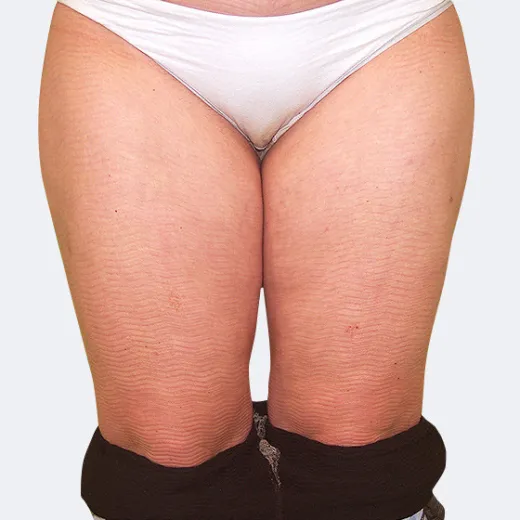 Image after