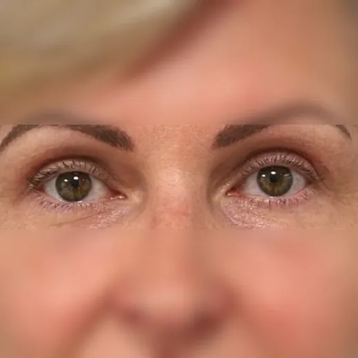 Image after