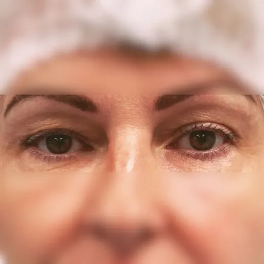 Image before