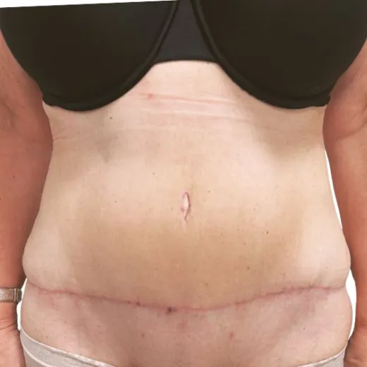 Image after