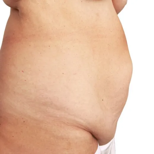 Image before