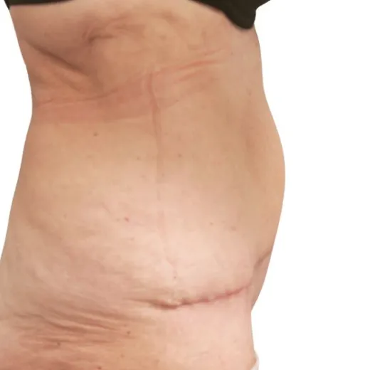 Image after
