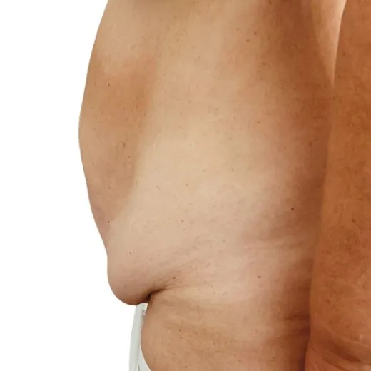 Image before