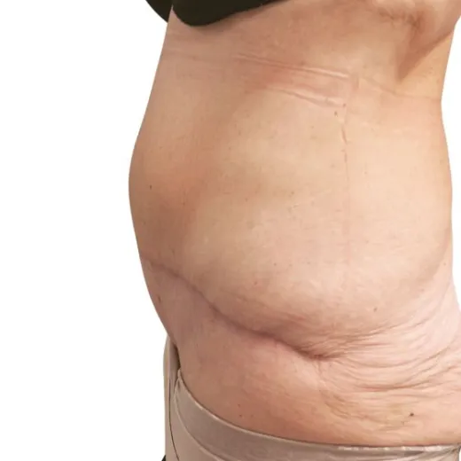 Image after