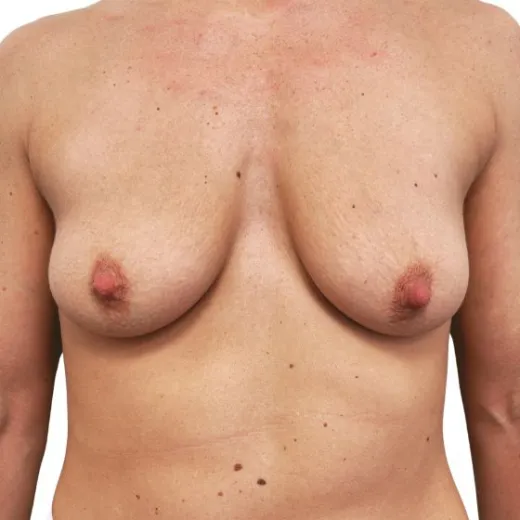 Image before