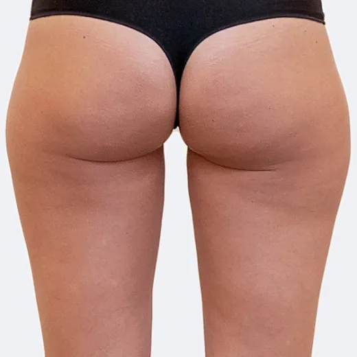 Image before