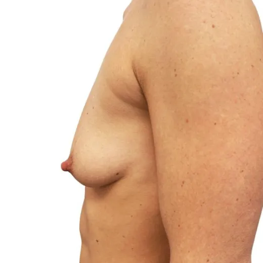 Image before