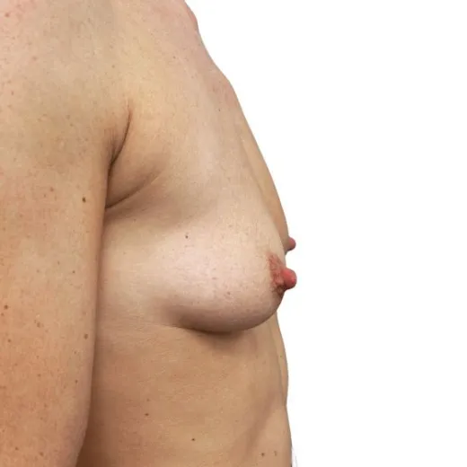 Image before